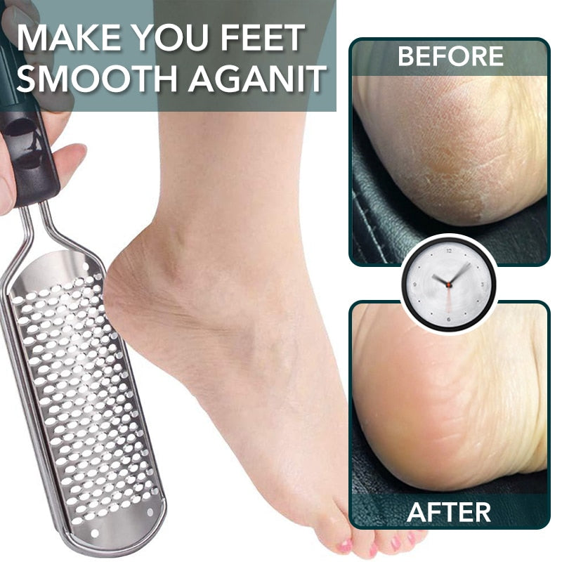 Foot File Callus Remover | Foot File for Pedicure | Wealth of Wellness